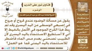 صورة لدي جروح في إصبع يدي اليسرى واستنجئ باليد اليمنى فما الحكم؟ الشيخ عبد الله الغديان