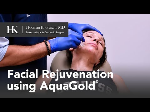 Facial Rejuvenation Using AquaGold Fine Touch by Dr. Hooman Khorasani