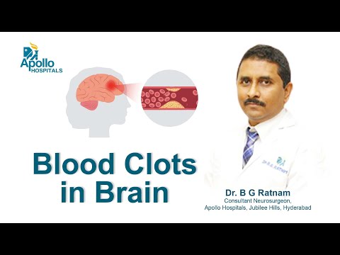 Blood Clots in Brain- Bleeding & Clotting | Dr B G Ratnam, Neurosurgeon | Apollo Hospitals Hyderabad
