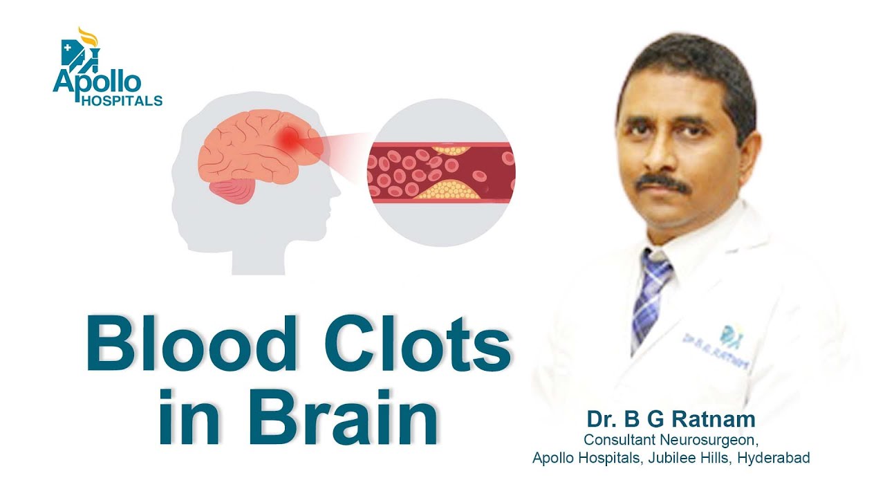 What causes a blood clot in the brain? More REF