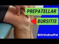 Prepatellar Bursitis (Anterior knee pain and swelling)