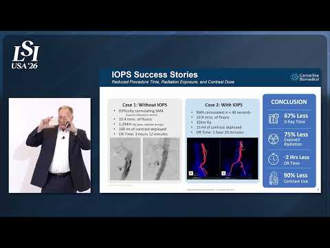 Jim Dillon, Centerline Biomedical - 3D non-x-ray surgical navigation for endovascular care | LSI USA '26