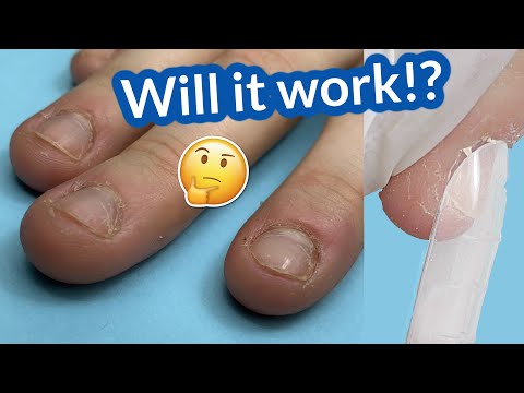 Dual Forms & Polygel for BITTEN NAILS – Will it work? Anna Nails Transformation