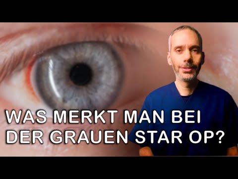 Dr. Ninios - Was merkt man bei der Grauen Star Operation? #augenarzt #katarakt #cataract