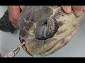 Sea Turtle with Straw up its Nostril - 