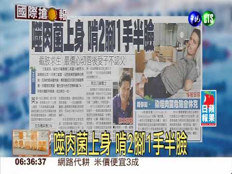 噬肉菌上身 啃2腳1手半臉