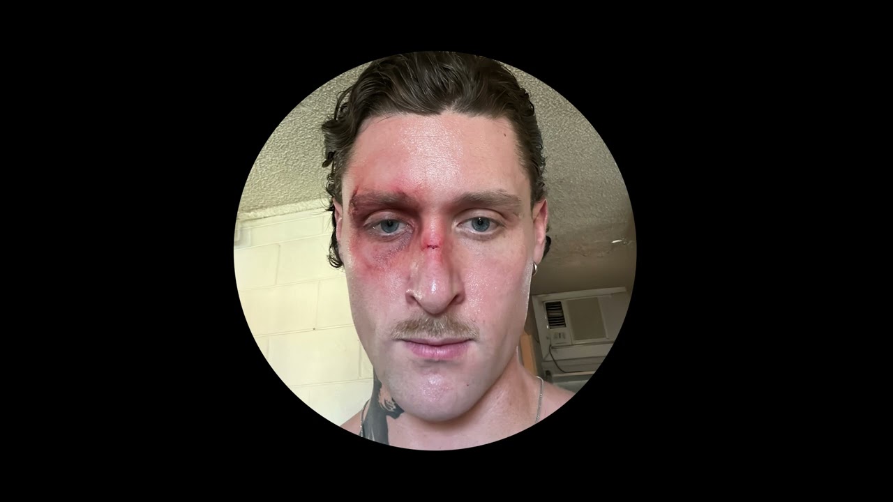 KETTAMA - It Gets Better (Forever Mix)