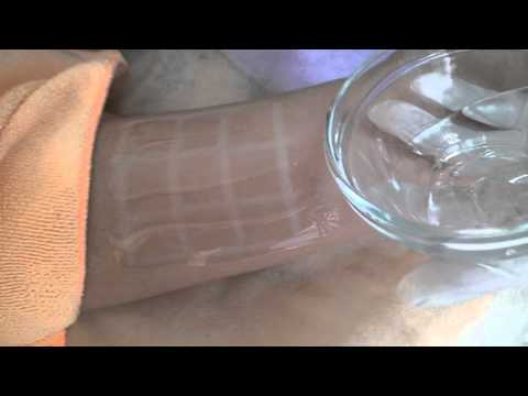 The operation of the hifu 13MM FU4.5-2S