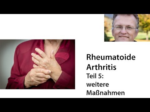 Verband für das Schultergelenk Novokuznetsk Jede Übung, die Sie mit Rückenschmerzen tun können
