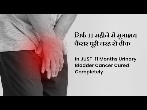 Cancer Healer Center successfully treats Urinary Bladder Cancer