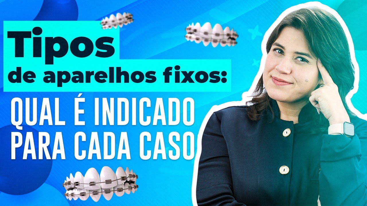Tipos de aparelhos fixos: qual é indicado para cada caso?