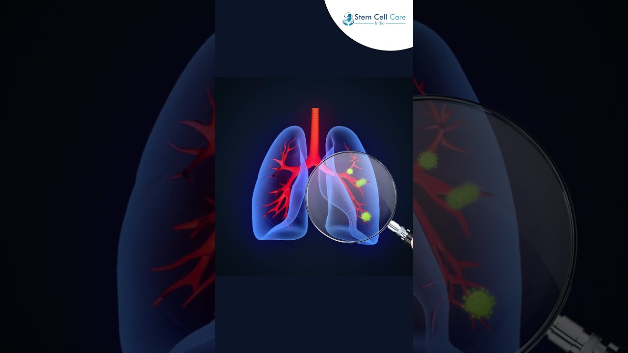 COPD Awareness: Breathing Better with Stem Cell Therapy | Lung Disease | Regenerative Medicine