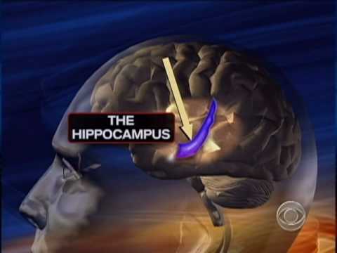 Diabetic Brain Damage Risk