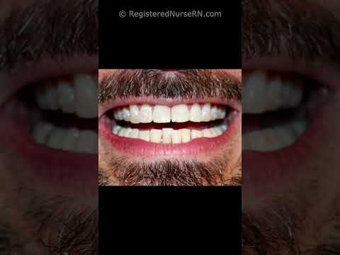 Nurse ASMR Sounds You ll Hear During Nursing Skills shorts asmr