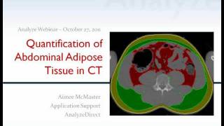 preview picture of video 'Quantification of Abdominal Adipose Tissue from CT using Analyze 10.0 - Webinar'
