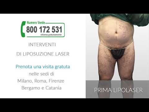 Mal di schiena quando mi alzo e mi siedo Artrosi del quadro spalla
