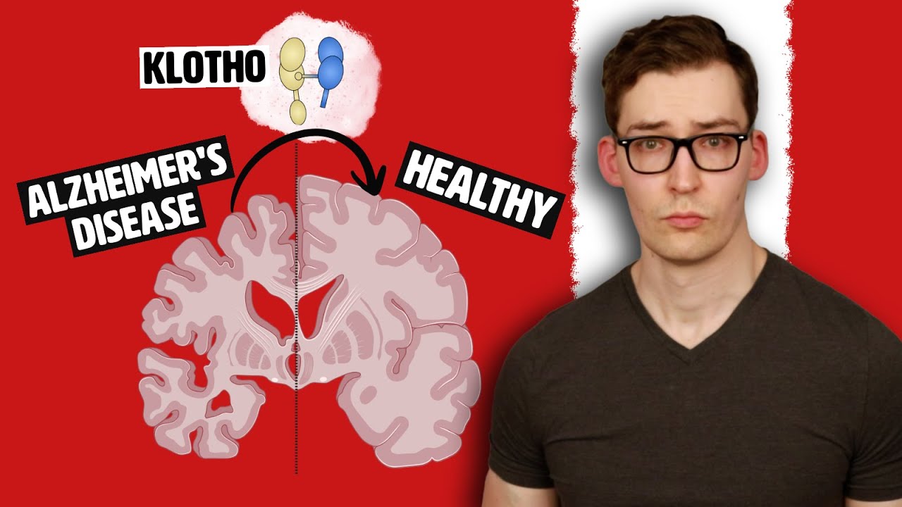 Unique Neuroprotective Effect of Klotho and How to Increase it Naturally