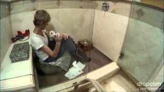 Cottoncam progression after pneumonia.