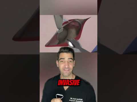 Minimalinvasiver Hüftersatz