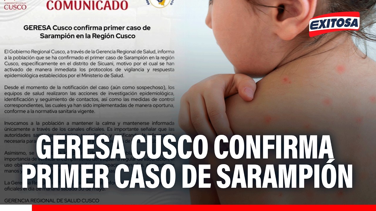 🔴🔵 Autoridades de la salud ya está tomando medidas de control ante este primer caso