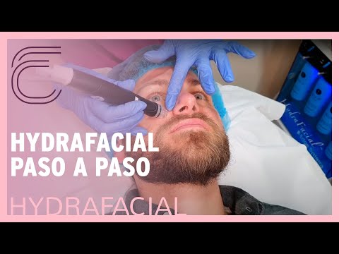 LIMPIEZA FACIAL 🧽 peeling químico y mucho más con HYDRAFACIAL
