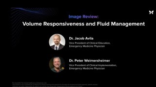 Image Review: Volume Responsiveness and Fluid Management | Butterfly Network