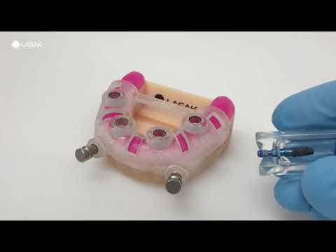 Plně navigovaná chirurgie BioniQ | LASAK