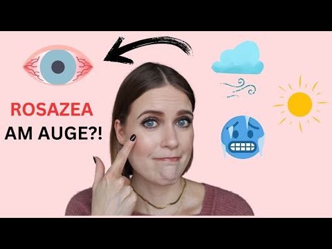 ROSAZEA AN DEN AUGEN? 👀 | OKULÄRE ROSAZEA | TRIGGER, SYMPTOME & MEINE ERFAHRUNGEN | PRODUKT-TIPPS