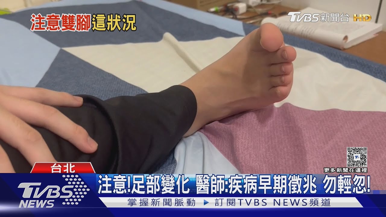 注意!雙腳發出警訊 醫師警告:「這類型」人若輕忽下場慘!