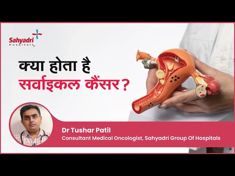 What is Cervical Cancer
