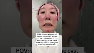 How to Shrink a Cystic Pimple FAST! Dermatologist’s Emergency Fix 🚨