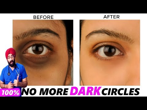 SCIENCE OF DARK CIRCLES : Reason to Remedy | Explained in ENG | Dr.Education Video