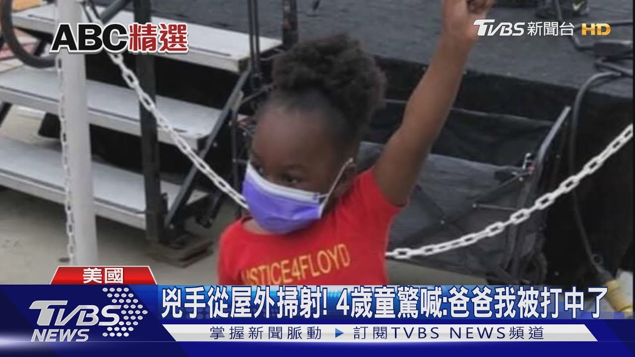 睡夢中子彈飛進來! 佛洛伊德姪女遭槍擊肋骨斷