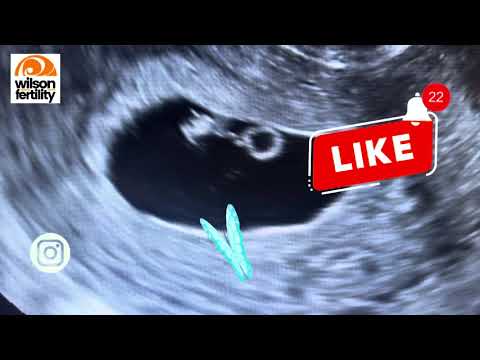 Embarazo de 6 semanas: se ve el latido