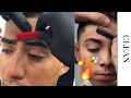 Male Eyebrow Shaping Before And After