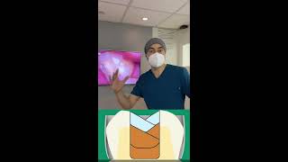 ¿Por qué fracasa una resina dental/empaste #shorts