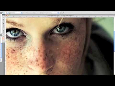 Liberarsi da konopushka Come livellare il tono della persona se ci sono lentiggini
