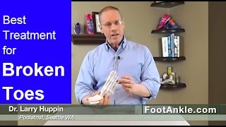 What is the Best Treatment for a Broken Toe? (and why you should NEVER buddy tape a stubbed toe)
