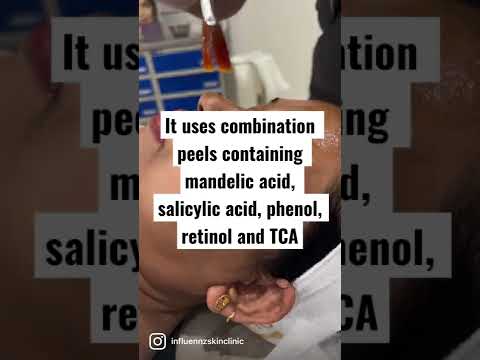 Spotless Peels Video