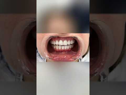 Güzelliğine Güzellik Katabildiğimiz Hastamız Mutlu, Biz Mutlu❤️