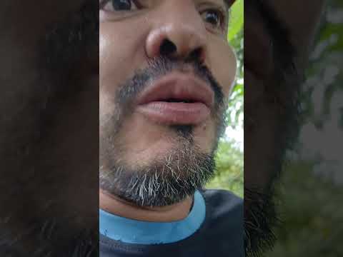 granja el canal albania caqueta colombia 30 enero 2026 olmar emelin aylin