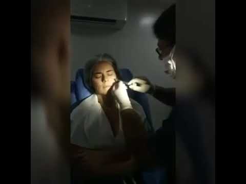 Relleno de ácido hialurónico - Dermatólogo Cartagena