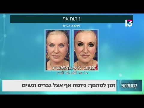 ניתוח אף אצל גברים ונשים