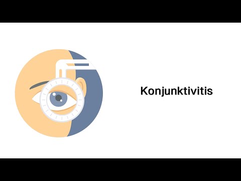 Konjunktivitis (Bindehautentzündung) - Erkrankungen der Augen