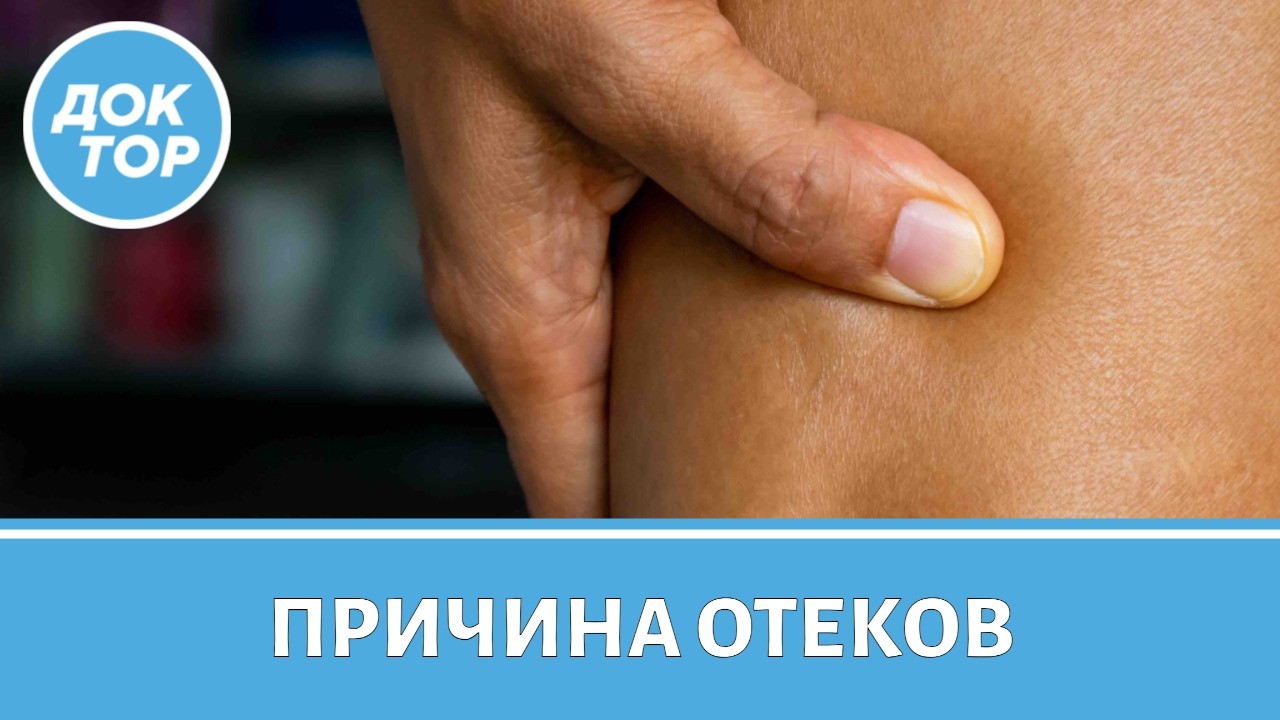 Кто на самом деле виноват в ваших отеках
