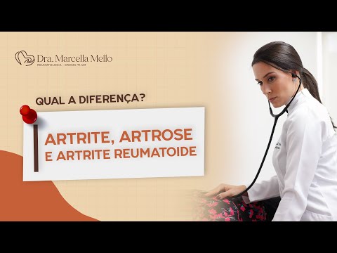ARTRITE, ARTROSE OU ARTRITE REUMATOIDE?