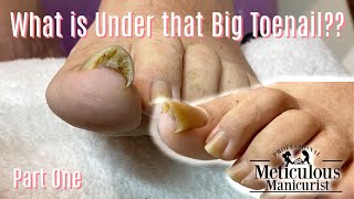 👣 Take Care of Your Toenail Pain at Home Online Ingrown Pedicure Lesson 👣