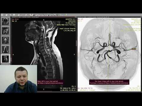 Мрт всего тела. Мрт снимки. Мрт диффузия всего тела онкологический скрининг. Кт тела человека. Комплексные обследования мрт.