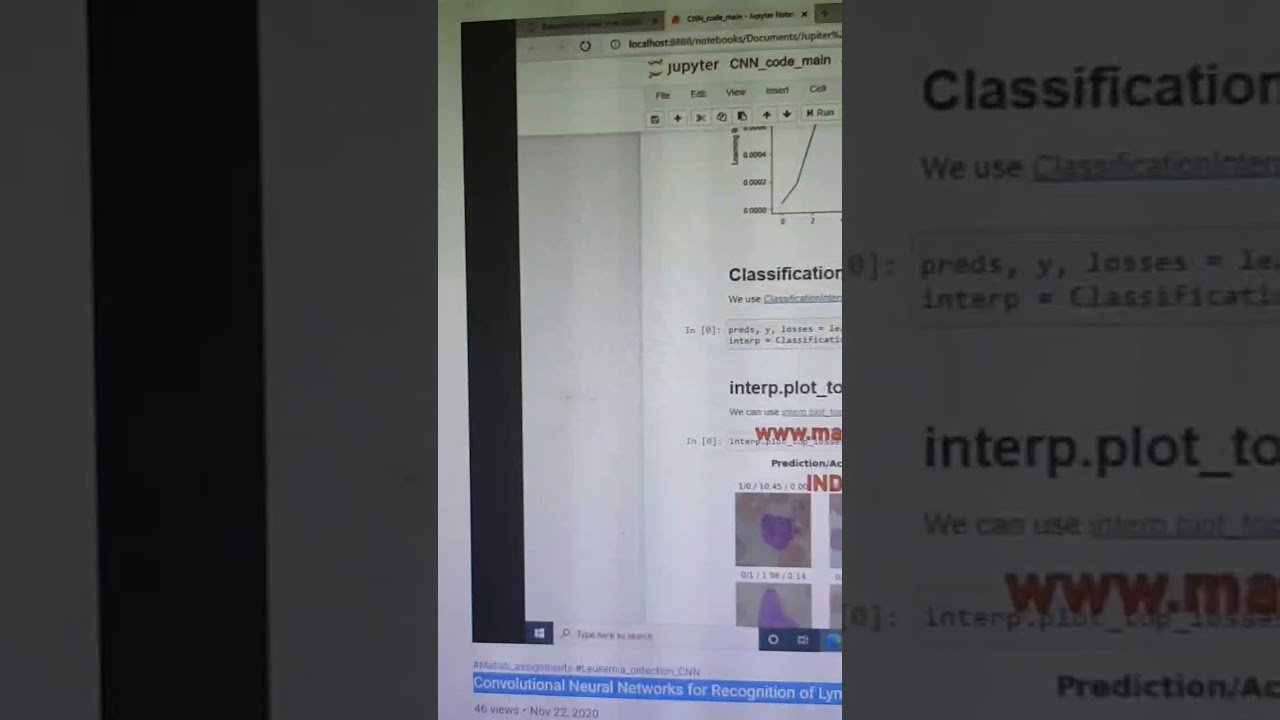 Convolutional Neural Networks for Recognition of Lymphoblast Cell Images - Leukemia detection CNN