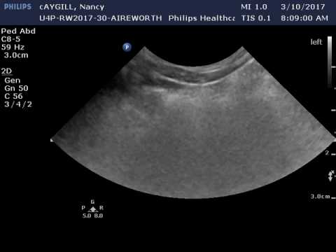 lung ultrasonography in a dog with acute pulmonary thromboembolism